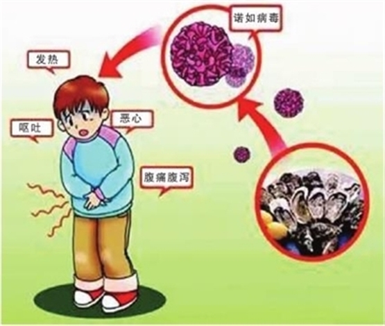 近期诺如病毒活跃